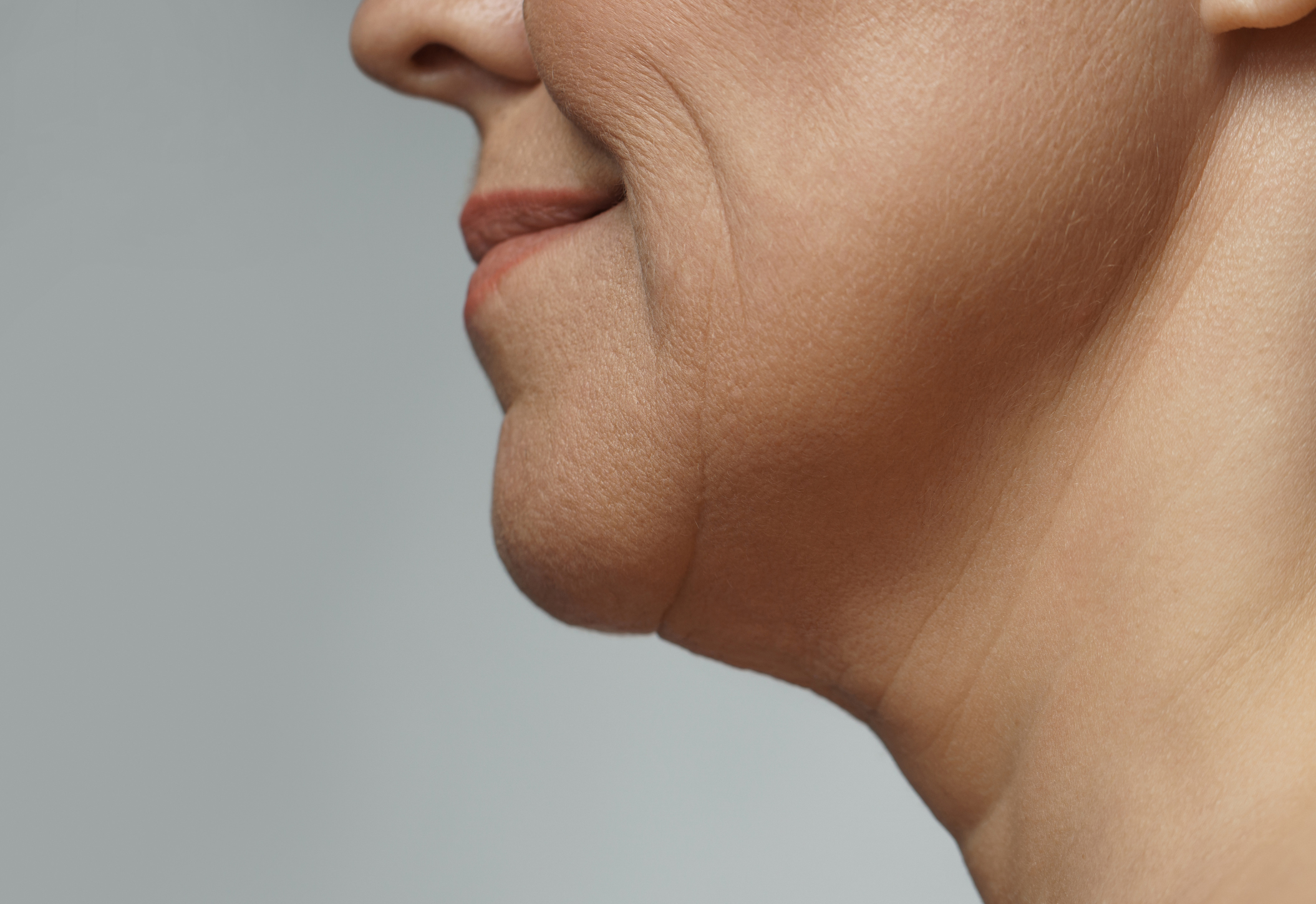 Agnes RF is perfect to contour Jawline and to minimize double chin