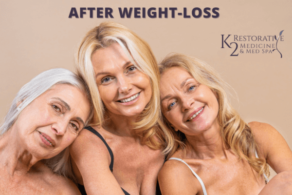 Effective Solutions for Sagging Skin After Weight Loss