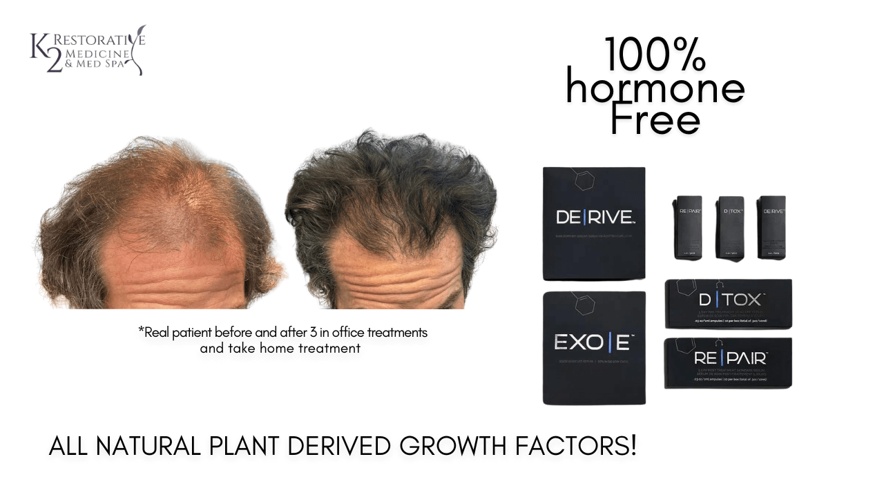 DERive Hair Restoration Results at K2 Medicine
