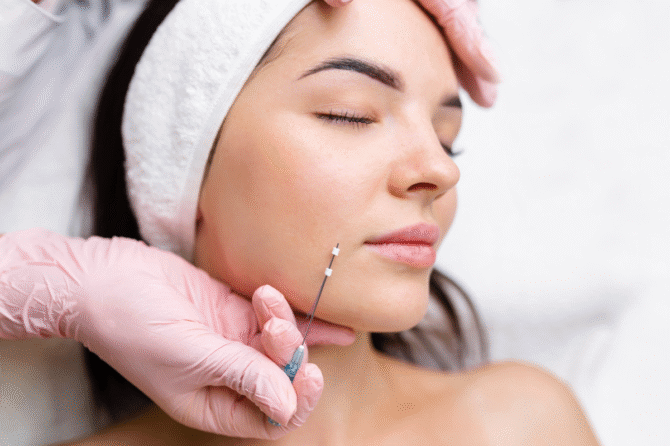 Trending PDO Threads for Face Lifting and Body Rejuvenation