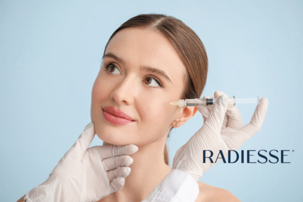 Radiesse with Dr. Kulback in Trussville, AL