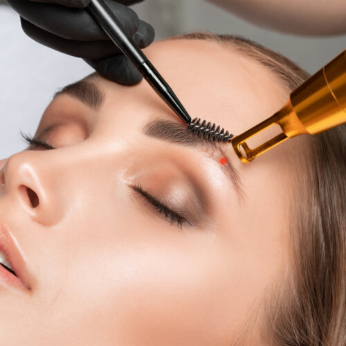 Toro Laser Tattoo Removal at Birhimgham,AL