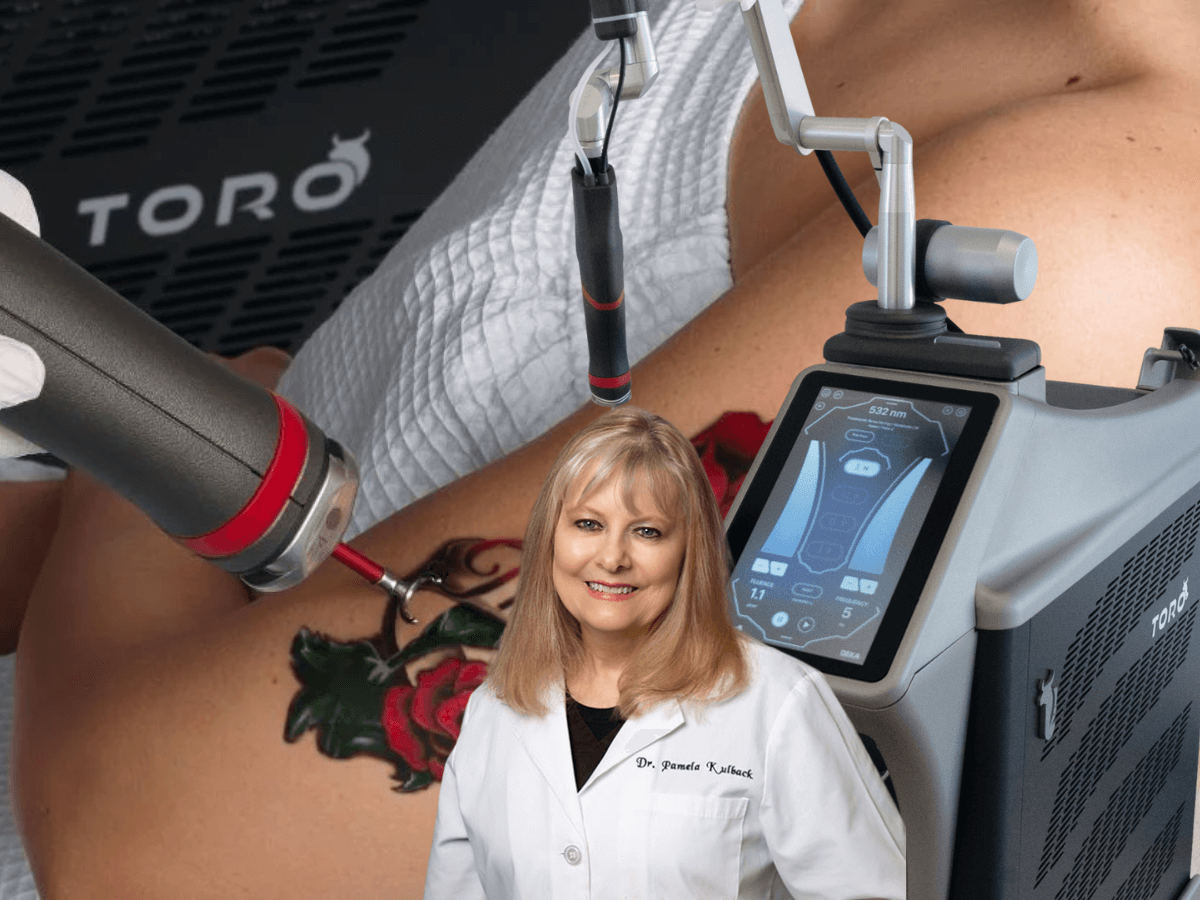 Toro Laser Tattoo Removal at K2 Restorative Medicine and Med Spa