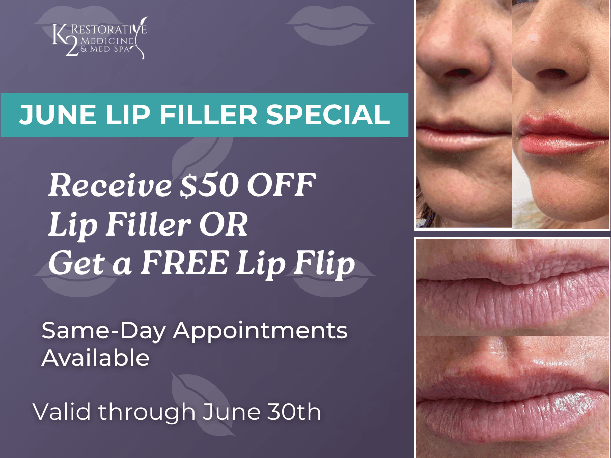 June Lip Filler Special