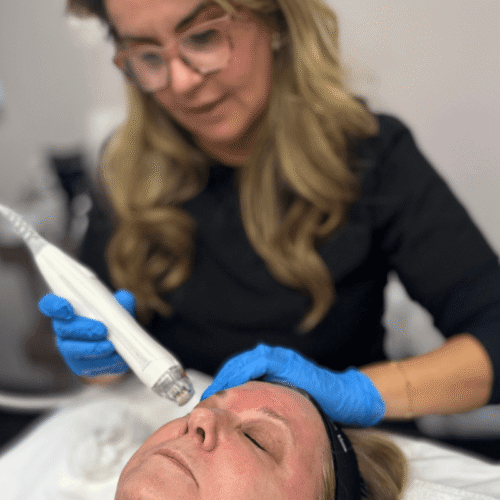 Virtue RF Microneedling in Trussville, AL