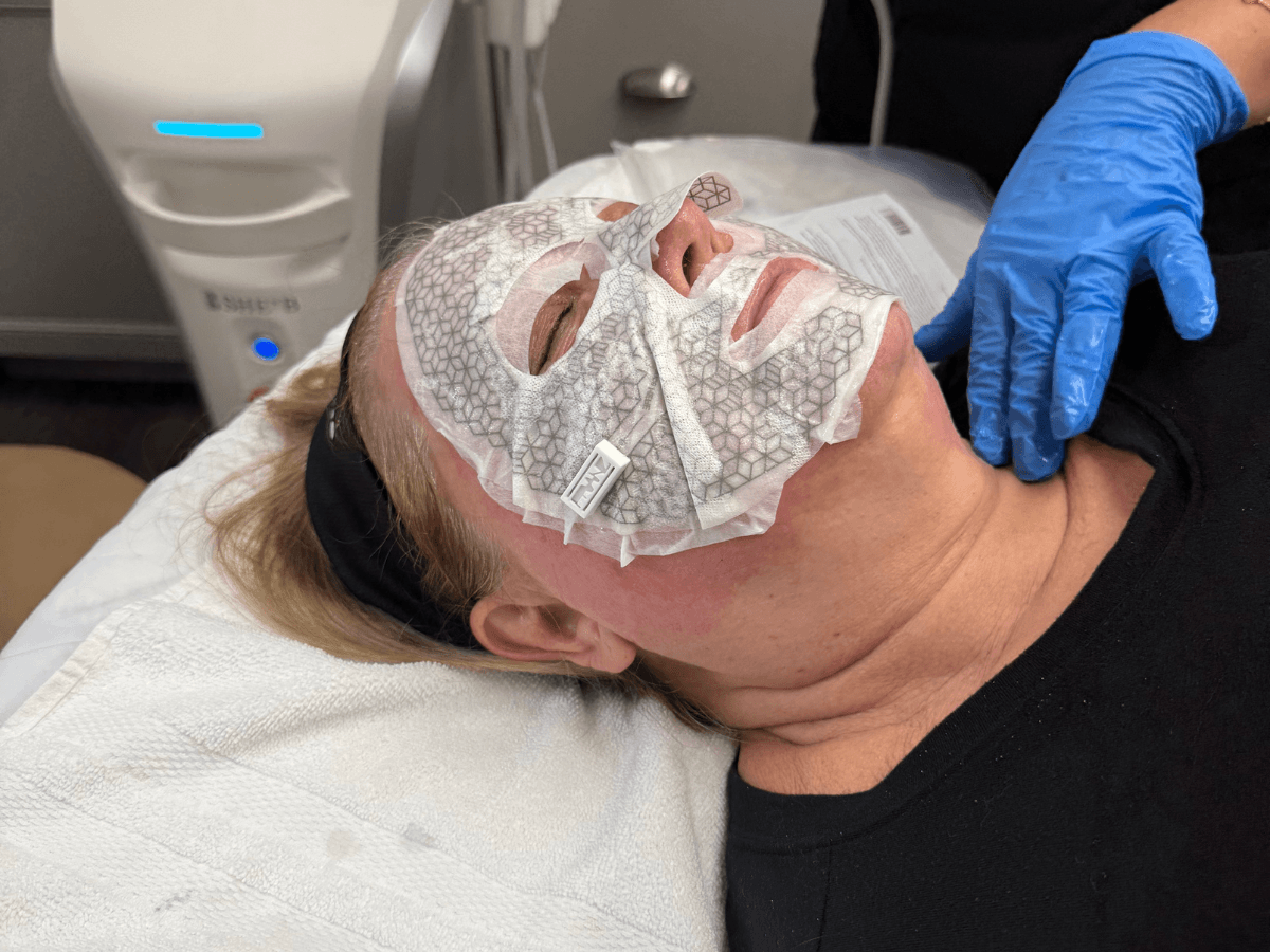 Virtue RF Microneedling with Jackie at K2 Restorative Medicine and Med Spa