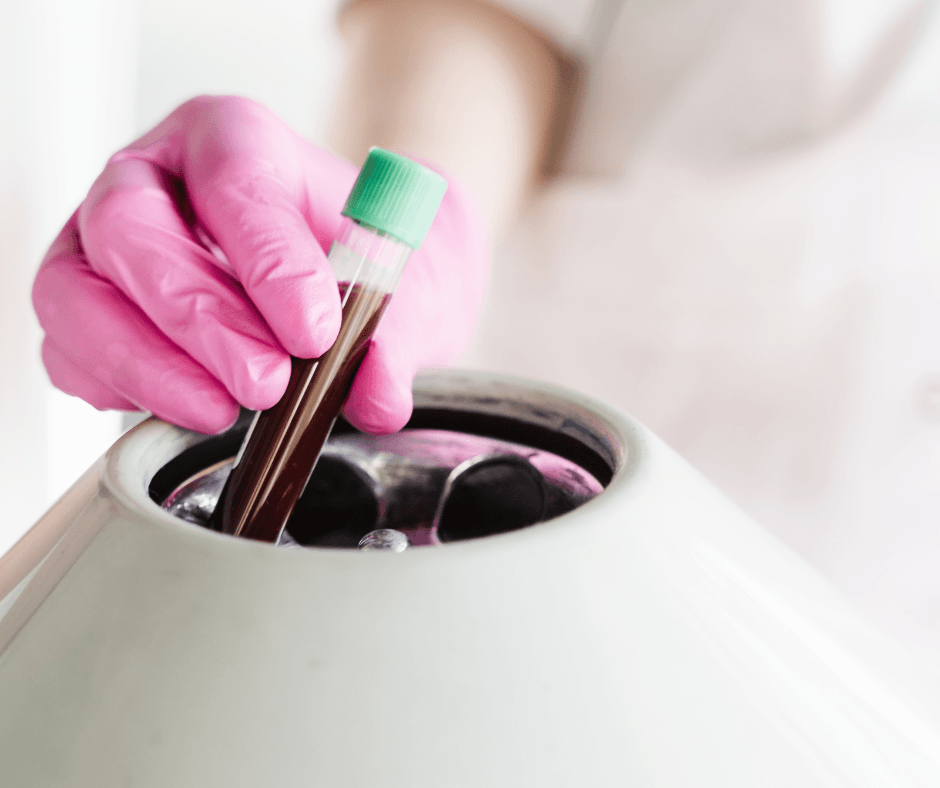 Blood sample being placed in a centrifuge to prepare platelet-rich plasma for PRP natural filler in Birmingham, AL