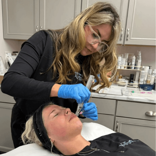Salmon DNA Meesoneedling at K2 Restorative Medicine and Med Spa