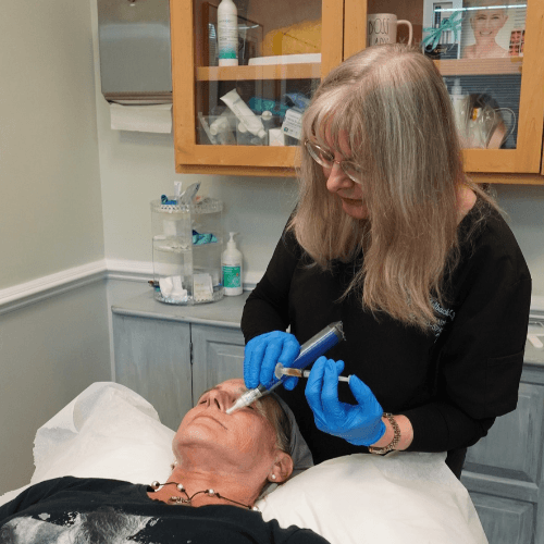 SkinPen at K2 Restorative Medicine and Med Spa